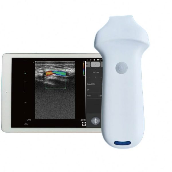 192 elementos de matriz 16hmz 20mhz NUEVA sonda lineal de ultrasonido Doppler a color inalámbrica de mano MSLPU96