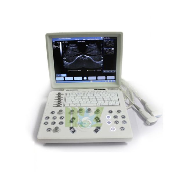2016 New use laptop as ultrasound machine MSLPU33 for sale