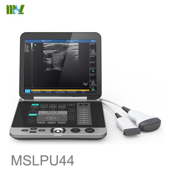 BSD Máquina de ultrasonido portátil con teclado de pantalla táctil B.S.D.PU44
