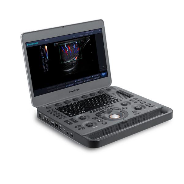 Precio eco doppler carotídeo SonoScape X3 : ecografie transfontanelara