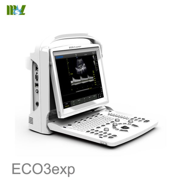 Ultrasonido portatil doppler Chison EC03exp precio