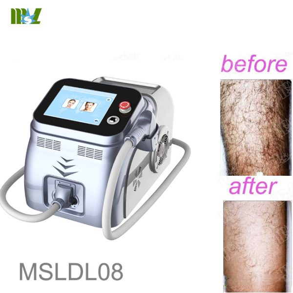 Mejor costo permanente e indoloro de eliminación de vello facial con IPL B.S.D.DL08