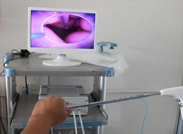 Herramienta de infusión visual canina para inseminación artificial B.S.D.DE01