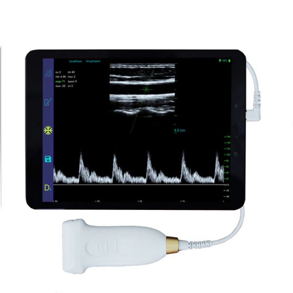 Comprar dispositivo de ultrasonido portátil profesional B.S.D.MU06 en Medsinglong