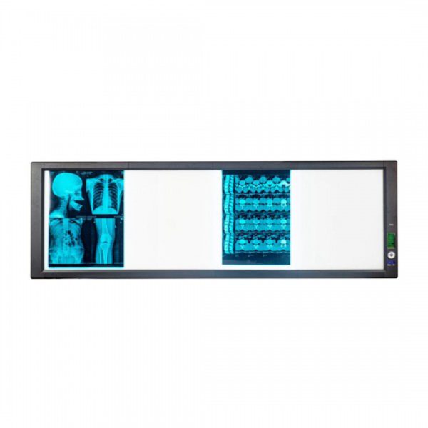 Comprar visor de películas médicas LED, visor de películas de rayos X industrial B.S.D.GP02.
