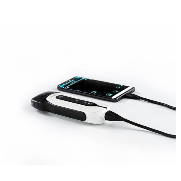 Máquina de ultrasonido Chison de diseño adaptable sonoeye
