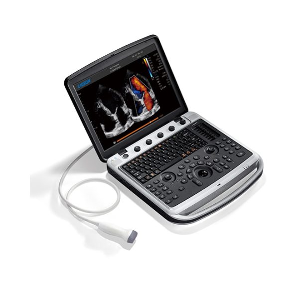 Máquina de ultrasonido de capacidad premium Chison SonoBook9