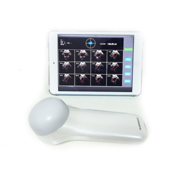 4D Wireless Bladder Scanner Wireless Ultrasound Transducer & probe