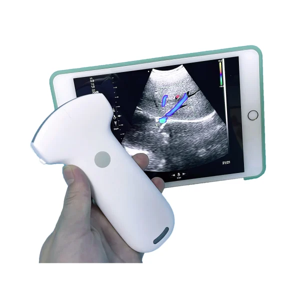 El escáner de ultrasonido a color inalámbrico portátil económico para veterinaria y humano con sonda convexa B.S.D.PU94