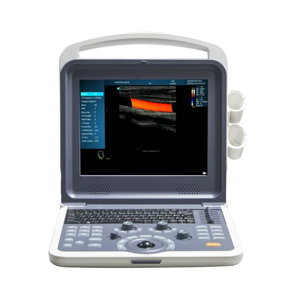 Máquina de ultrasonido Doppler en color portátil para hospital B.S.D.CU62