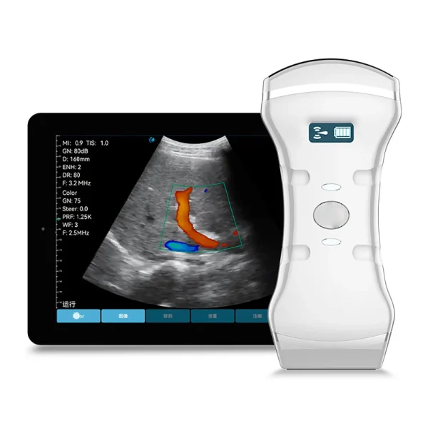 Fábrica 128 Elementos 3 En 1 Sonda de Ultrasonido Doppler de Color Inalámbrica Convex Lineal de Array de Fase B.S.D.MY10P