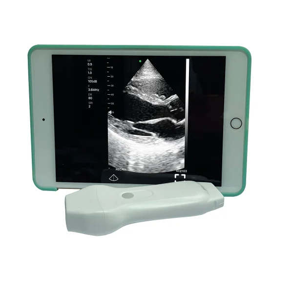 B.S.D.PU83 Escáner de ultrasonido Doppler en color portátil inalámbrico de mano más rentable Sonda de fase + Sonda lineal 2 en 1 B.S.D.PU83