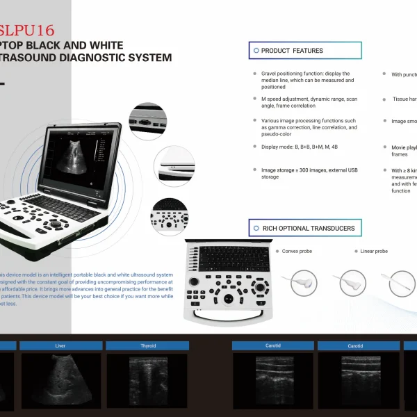 Instrumento de diagnóstico de ultrasonido digital completo para portátil multifunción B.S.D.PU16