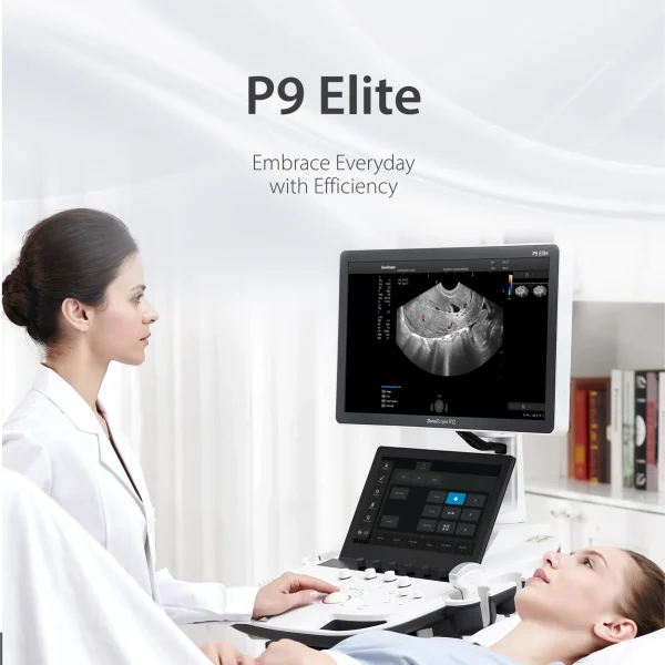 P11 Elite Sonoscape 4D Máquina de Ecografía Ecocardiografía AI Diagnóstico por Ultrasonido Equipo Médico Hospitalario