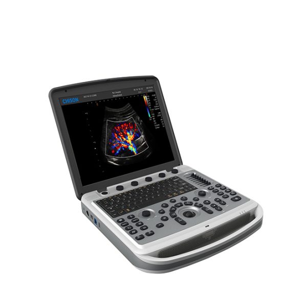 Advanced Color Ultrasound Machine Chison SonoBook6