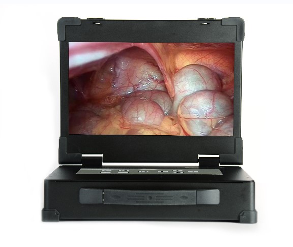 Cámara endoscópica médica portátil de 15.6 pulgadas para cirugía con fuente de luz LED MSLED10.