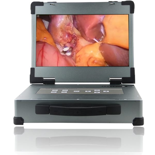 Cámara endoscópica médica portátil de 17.3 pulgadas con monitor HD para cirugía con fuente de luz LED MSLED12