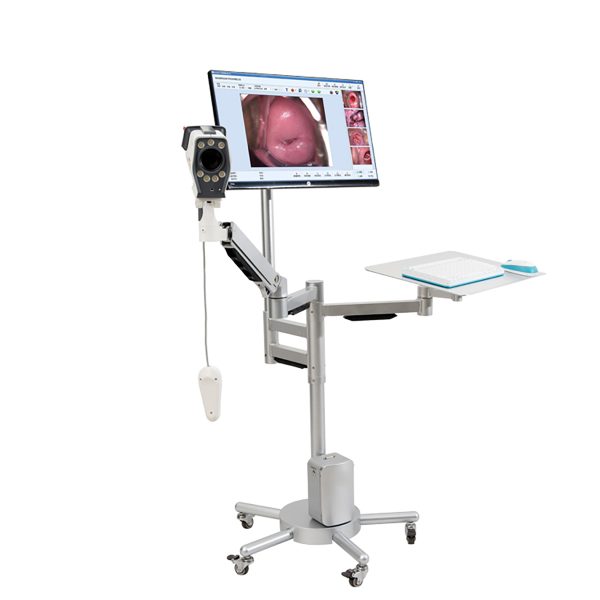 Colposcopio de video digital HD SONY para ginecología de la salud Colposcopio MSLCE23.