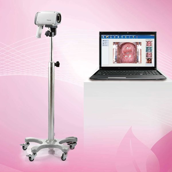 Colposcopio vaginal de video digital Edan para ginecología con doble diafragma LED C6A.