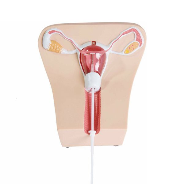 Dispositivo intrauterino anticonceptivo de esterilización médica de cobre T Dispositivo intrauterino Tcu-380A Tcu Iud MSLD1104