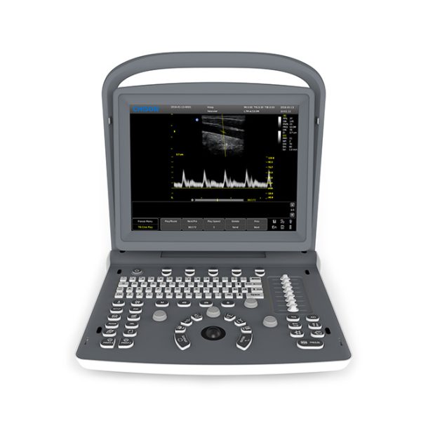 Doppler function ultrasound machine Chison ECO2