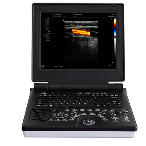 Ecógrafo Doppler en color en venta - MSLCU02