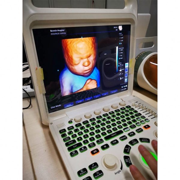 Ecografía médica portátil de ecocardiografía manual con máquina de ultrasonido Doppler a color 3D 4D MSLCU12
