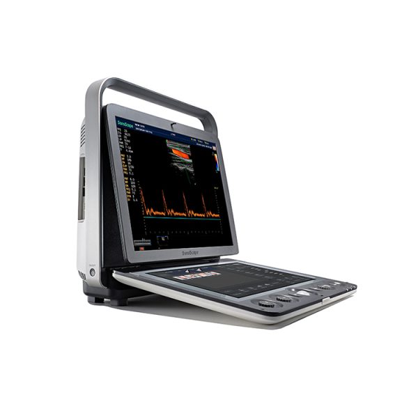 ecografie transfontanelara SonoScape S9 | ecografie doppler