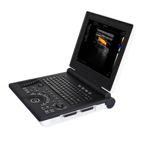 El escáner de ultrasonido Doppler a color más económico en venta - MSLCU02