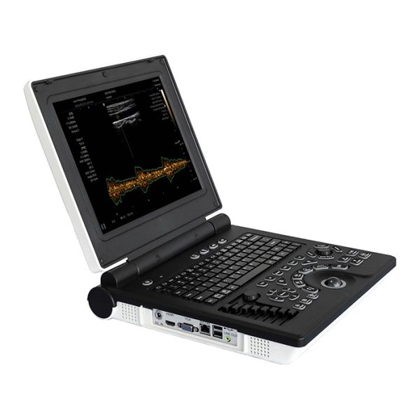 El escáner de ultrasonido Doppler en color más barato de China en venta - MSLCU02