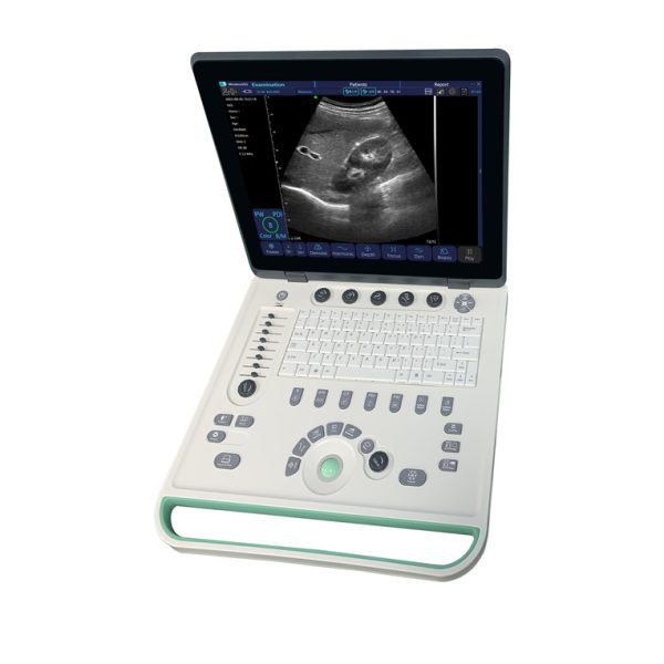 El mejor precio máquina de ultrasonido portátil instrumentos de ultrasonido médico para diagnóstico hospitalario MSLCU09