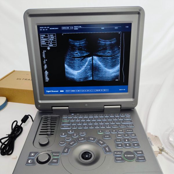 Equipo de ultrasonido portátil negro médico, máquina de ultrasonido portátil para humanos MSLPU11.