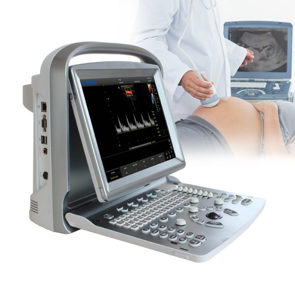 Equipos de ultrasonido médico Chison ECO5 portátiles 4D de color Doppler para abdomen/urología/vascular.