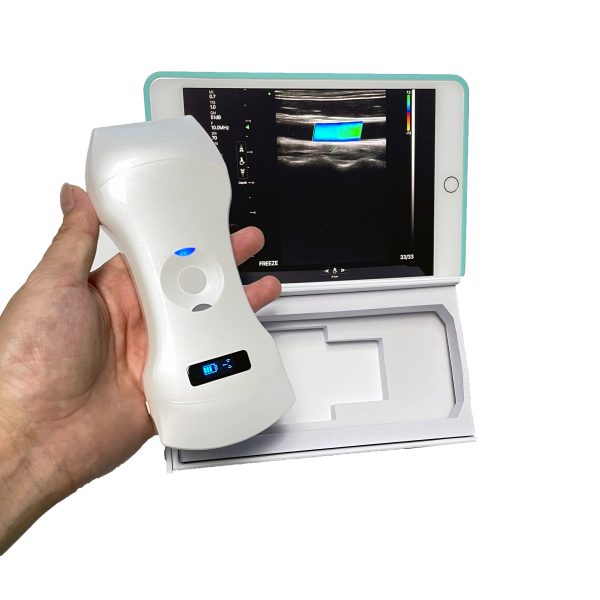 Escáner de ultrasonido Doppler en color 3 en 1 inalámbrico con sonda cardíaca de matriz de fase lineal y convexa MSLAA114