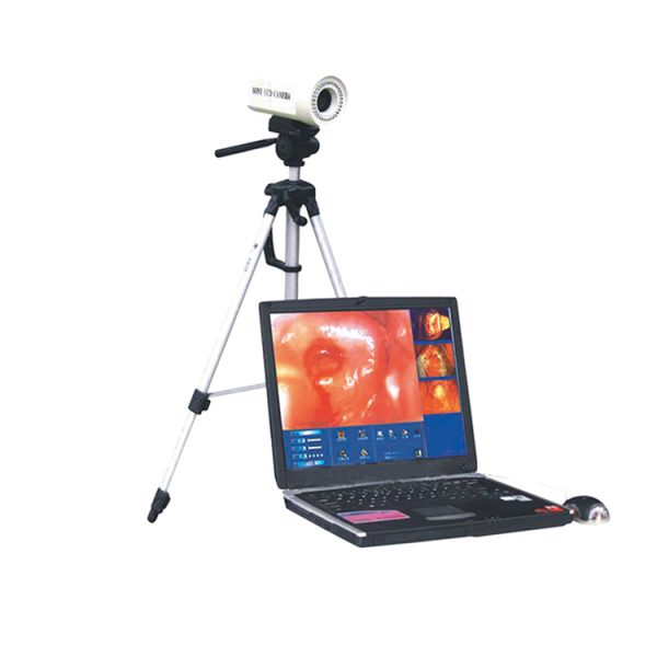 Estación de trabajo de colposcopio digital para laptop MSL para uso en mujeres MSLCE01 en venta