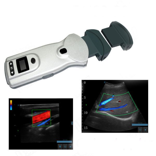 Exploración de ultrasonido abdominal inalámbrico Doppler MSLCU88- Medsinglong