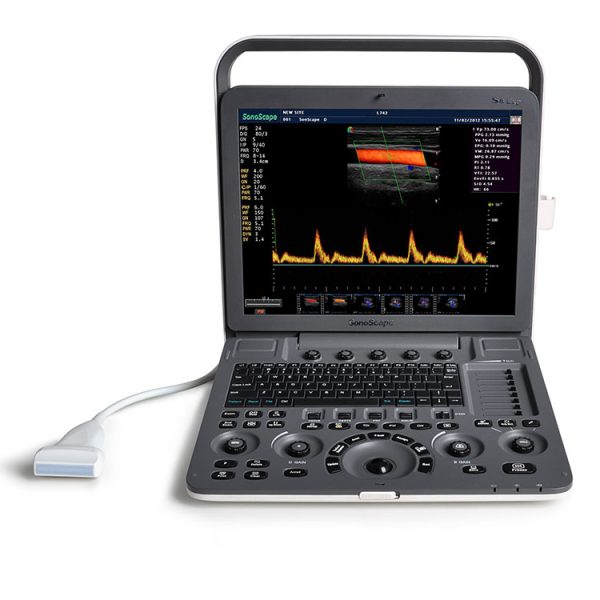 Factory direct sales best sonoscape ultrasound machine S8EXP