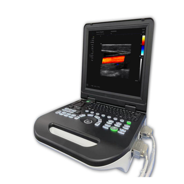 La máquina de ultrasonido portátil digital de equipo médico humano B Ultras MSLCU08.