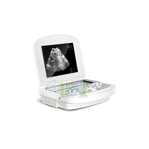 Laptop ultrasound factory sell directly & cheap laptop USG with CE approved MSLPU28