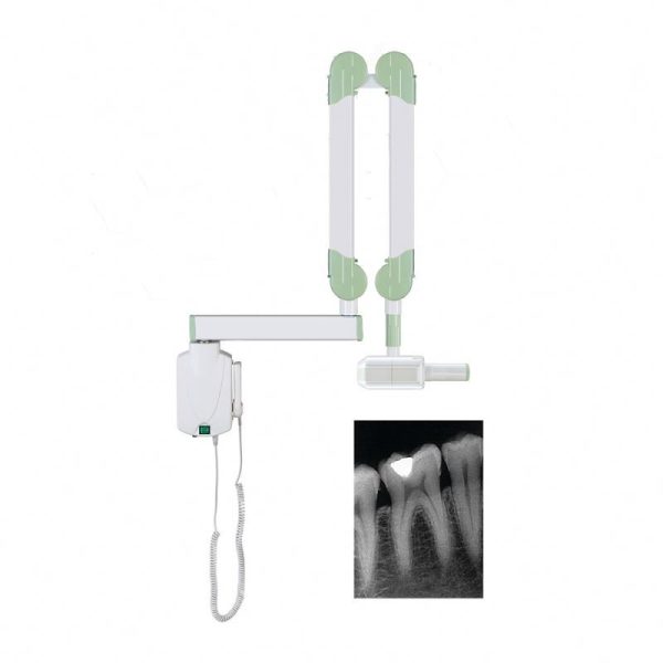 Máquina de rayos X dental digital montada en la pared a precio económico
