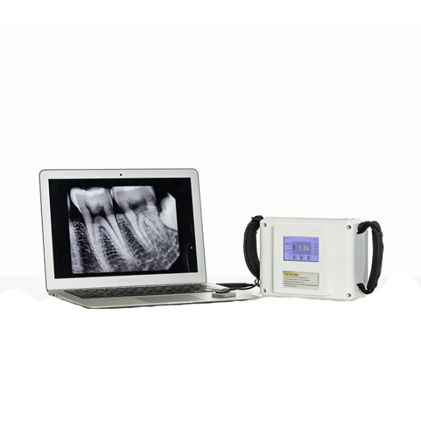 Máquina de rayos X dental MSLK12 en venta