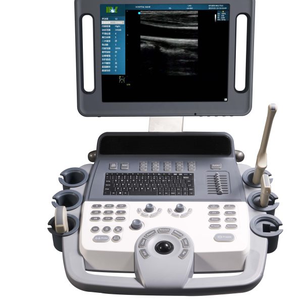 Máquina de ultrasonido 3D 4D, escáner de ultrasonido médico, doppler de color Sonoscape S6