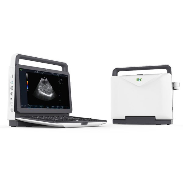 Máquina de ultrasonido Doppler en color diagnóstico 3D/4D Sonoscape E2 comparable