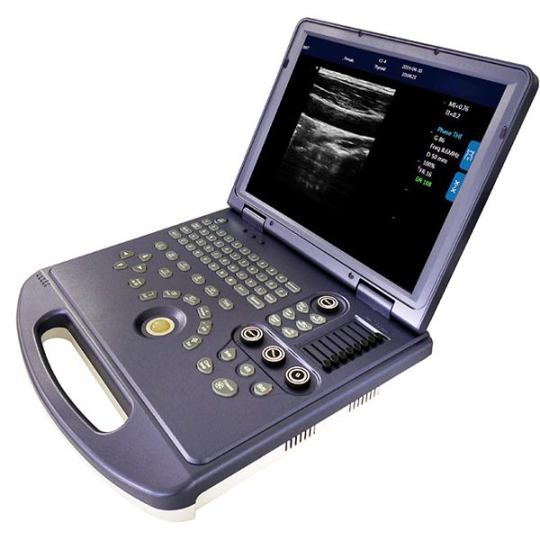 Máquina de ultrasonido médico de diagnóstico en blanco y negro totalmente digital MSLPU75