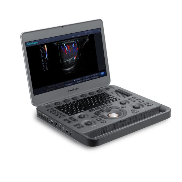 Máquina de ultrasonido portátil a color Sonoscape X5 Doppler para la venta