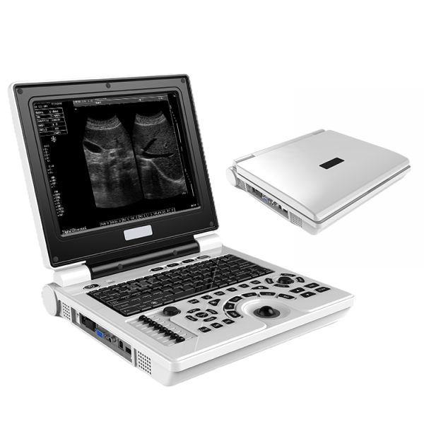 Máquina de ultrasonido portátil médico para fisioterapia, ultrasonido portátil en blanco y negro, escáner de ultrasonido digital portátil.