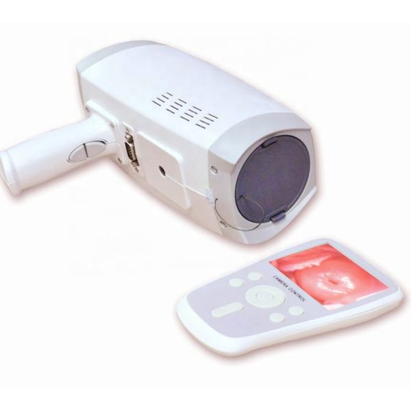 Mini Handheld Video Colposcopio Precio Para Vagina, Fabricantes de Cámara de Colposcopio Digital Portátil MSLAY08