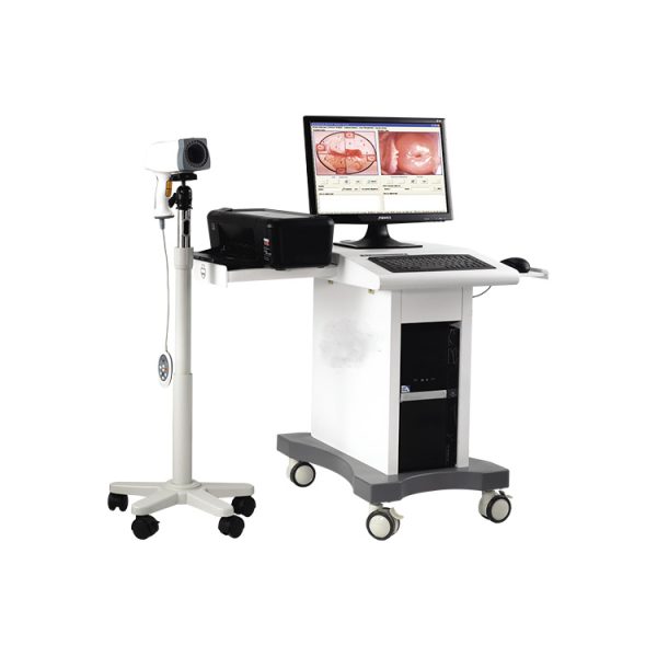 MSL Colposcopio máquina de video para ginecología MSLCE06 en venta