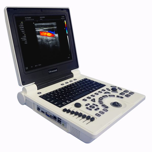 MSL laptop Máquina de ultrasonido Doppler en color MSLCU26 en venta