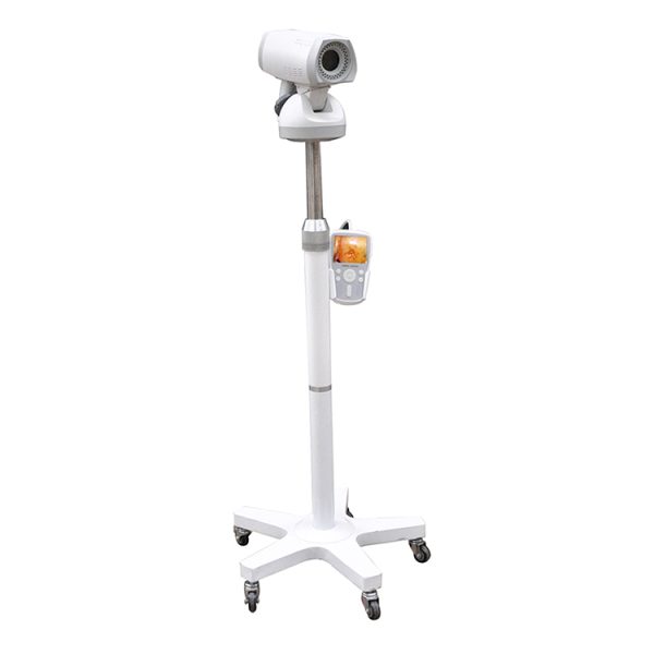 MSLAY07 Colposcopio Vaginal Portátil con cámara de video digital y trípode